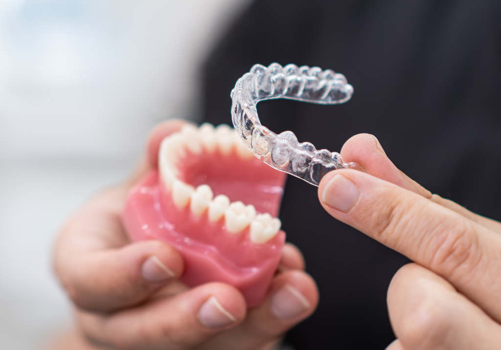 Unsichtbare Zahnspange (Invisalign) für eine schonende und unauffällige Zahnkorrektur in 1210 Wien